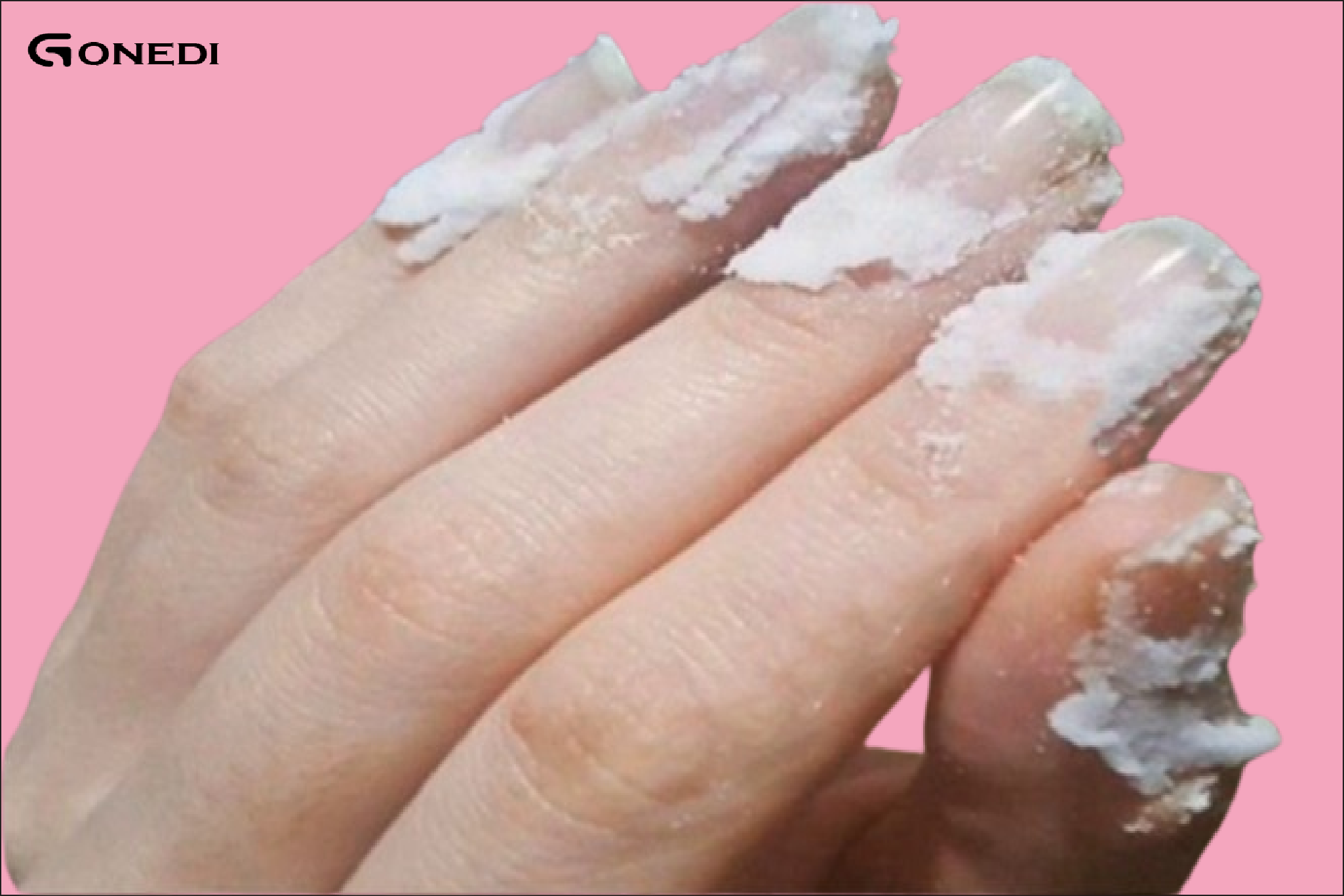 Rub some baking soda on your nails and see what happens?