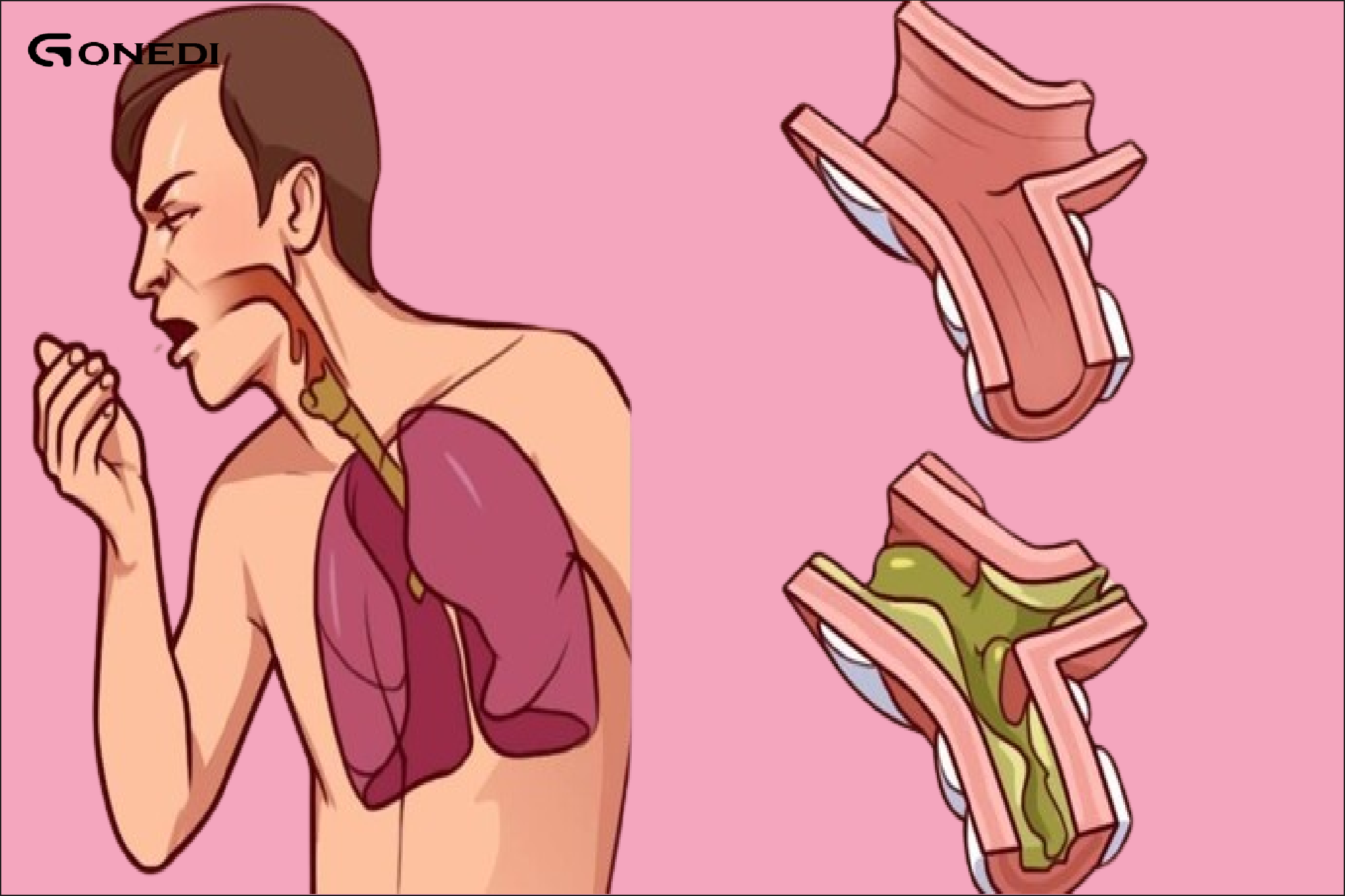Effective Ways to Clear Phlegm and Mucus from the Chest and Throat