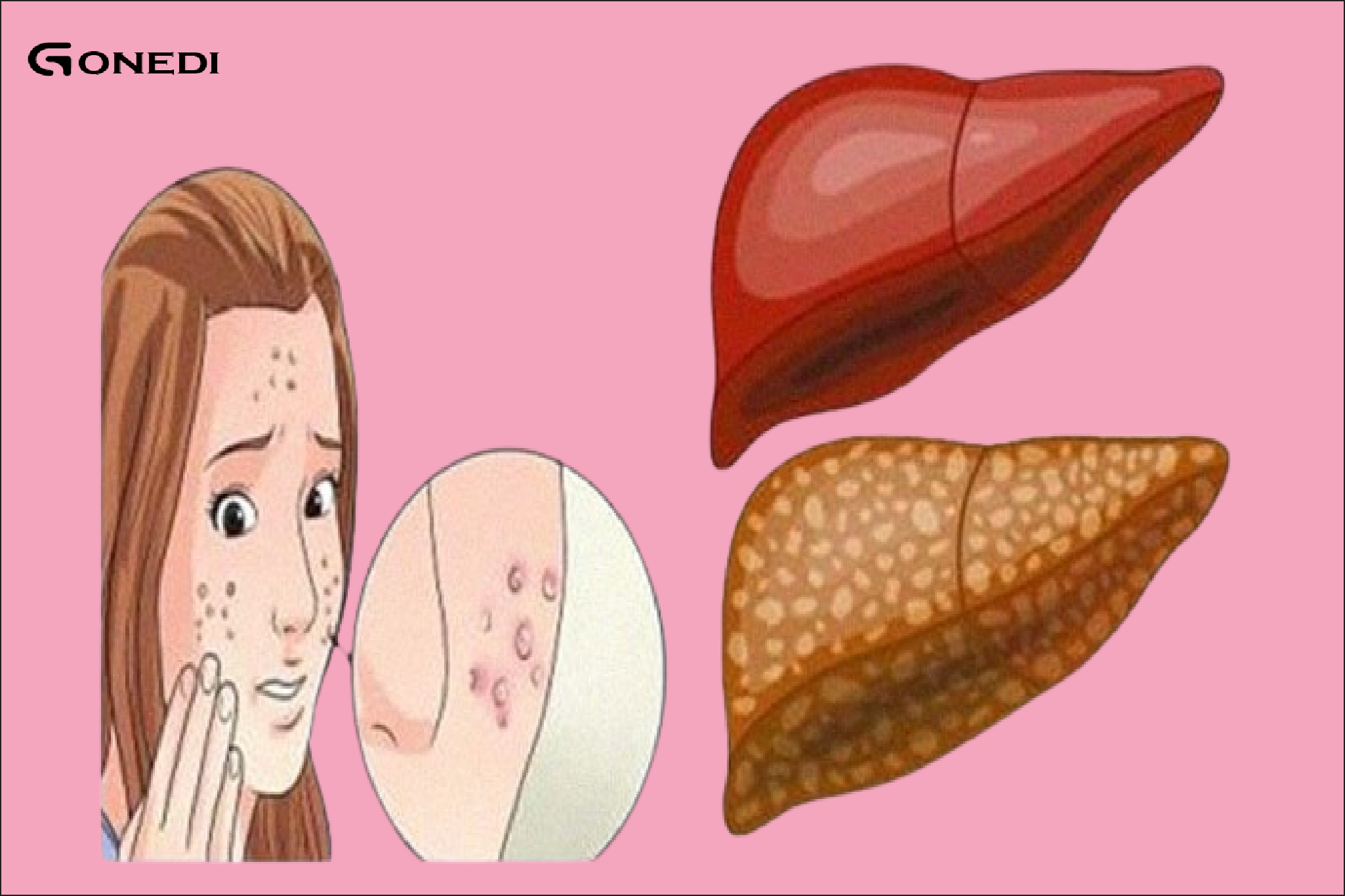 Screening for liver toxins: 6 warning signs and strategies for recovery