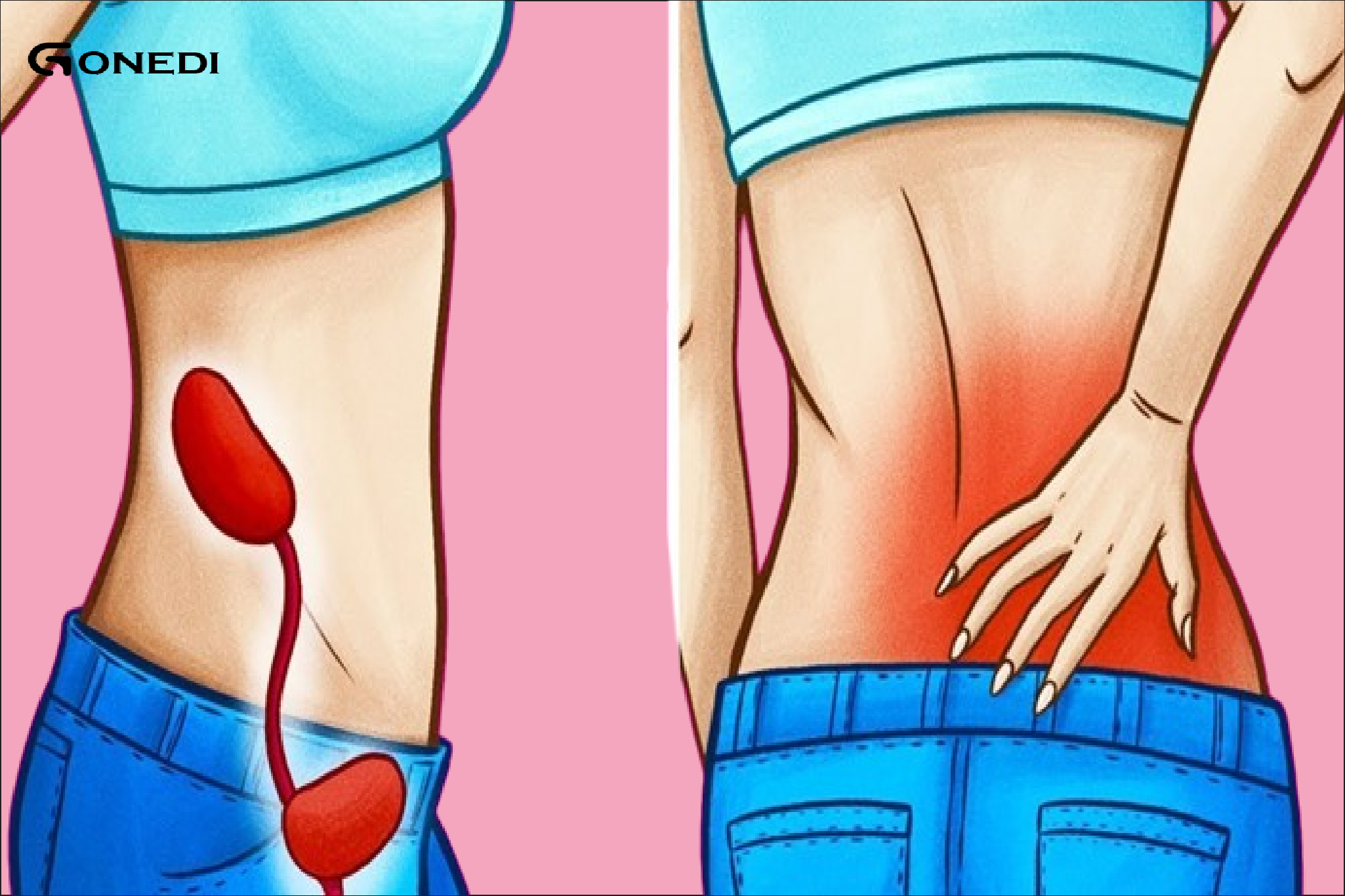 7 warning signs of kidney problems