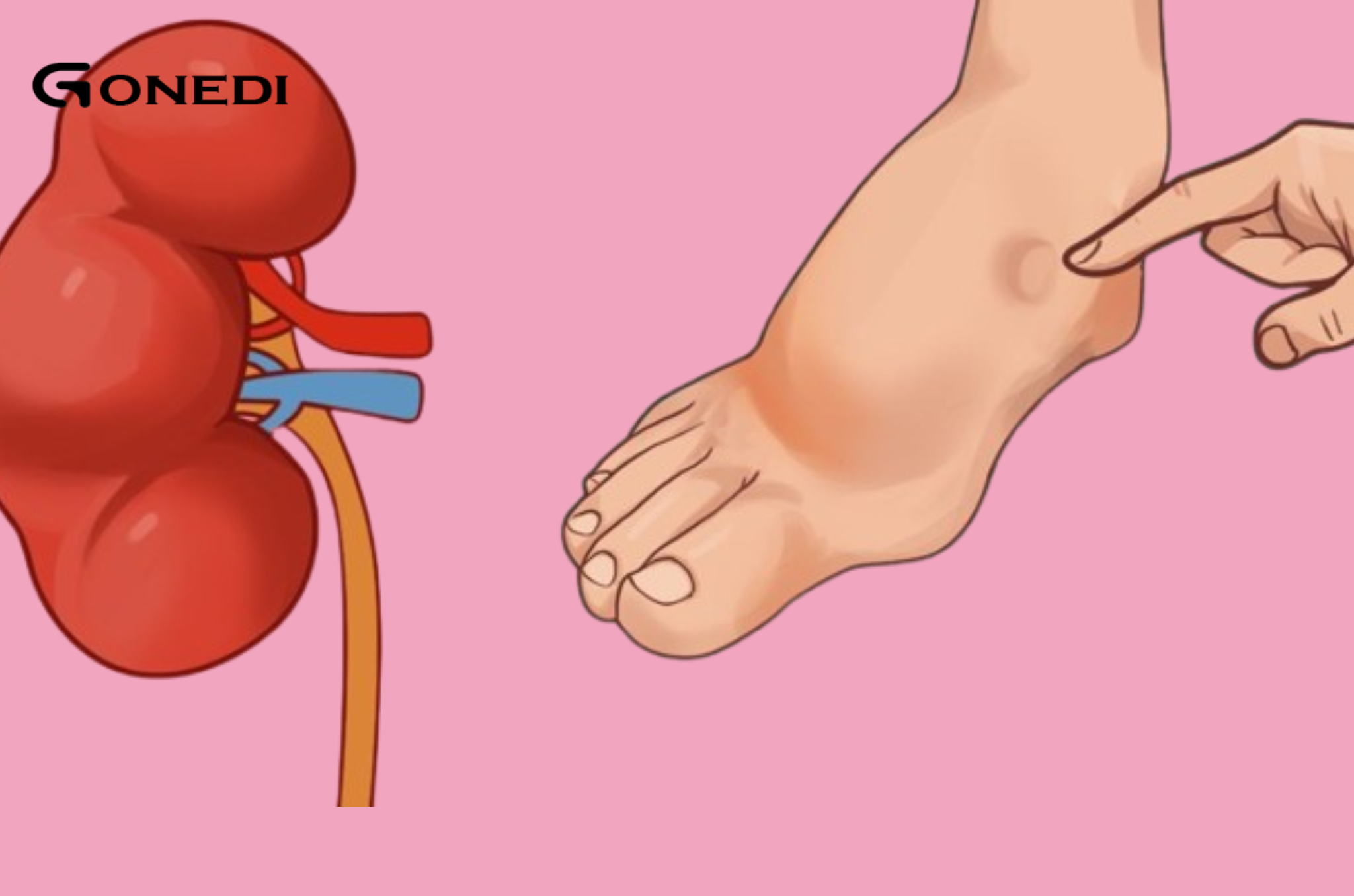 If your kidney is in danger, your body will give you these 7 signs!