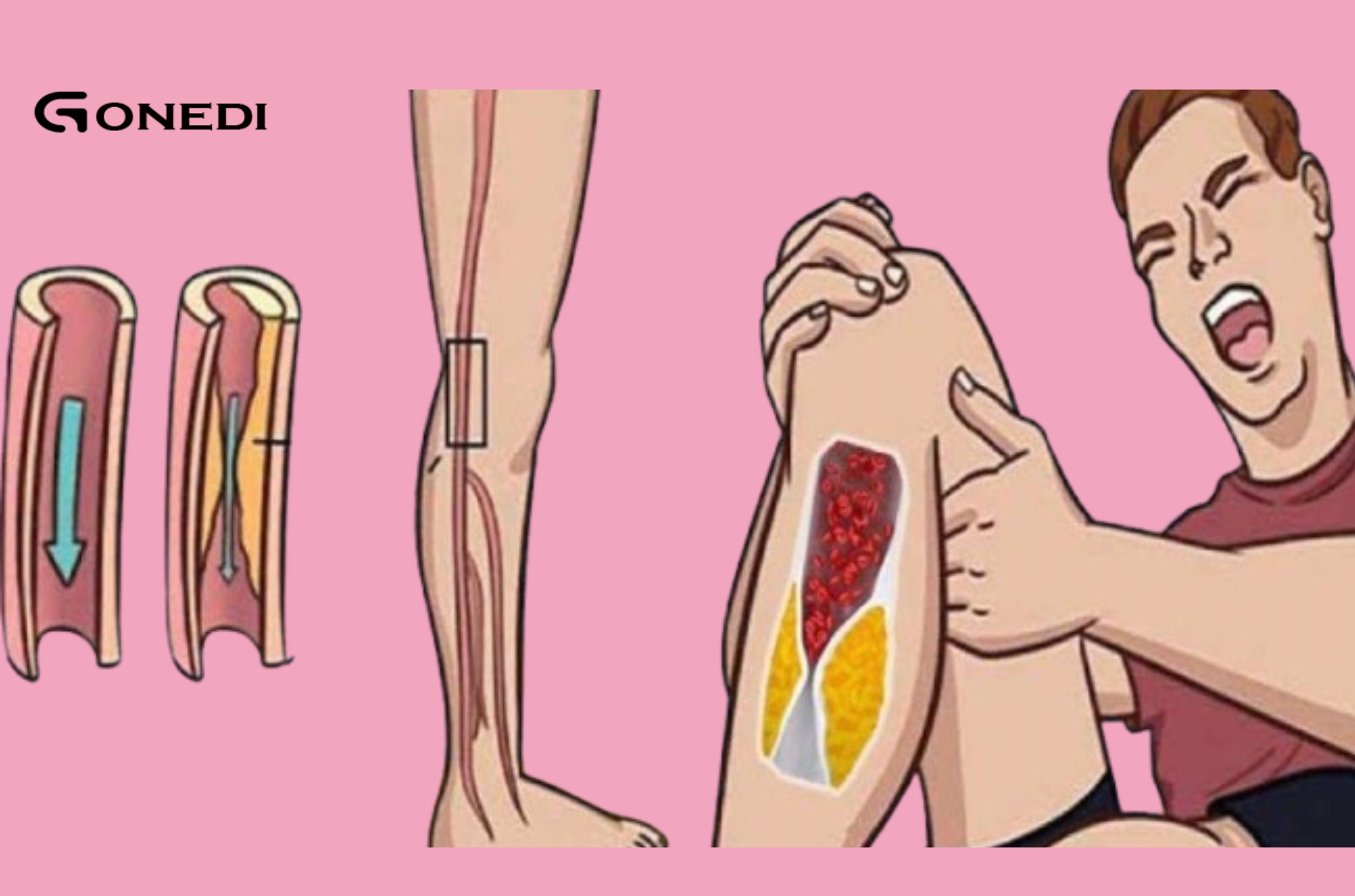 Here are 7 warning signs that indicate clogged arteries.